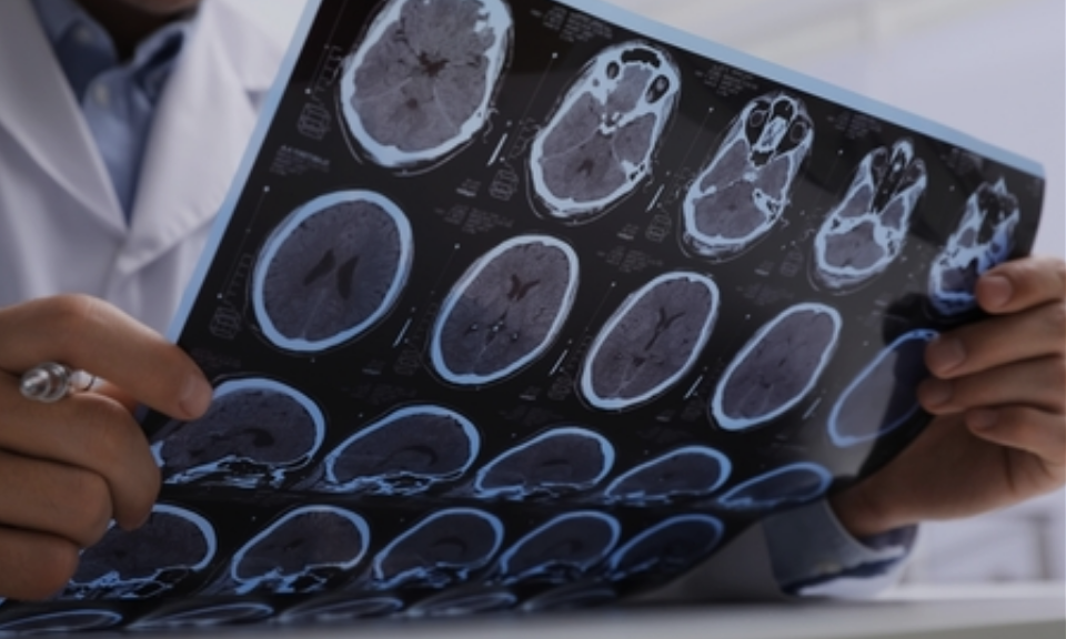 Brain scan imaging